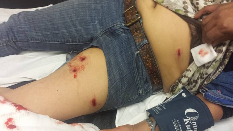 Mujer Mapuche es baleada por carabineros en brutal allanamiento